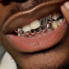 Grillz Intégral Plaqué-Or & Argent – Image 6