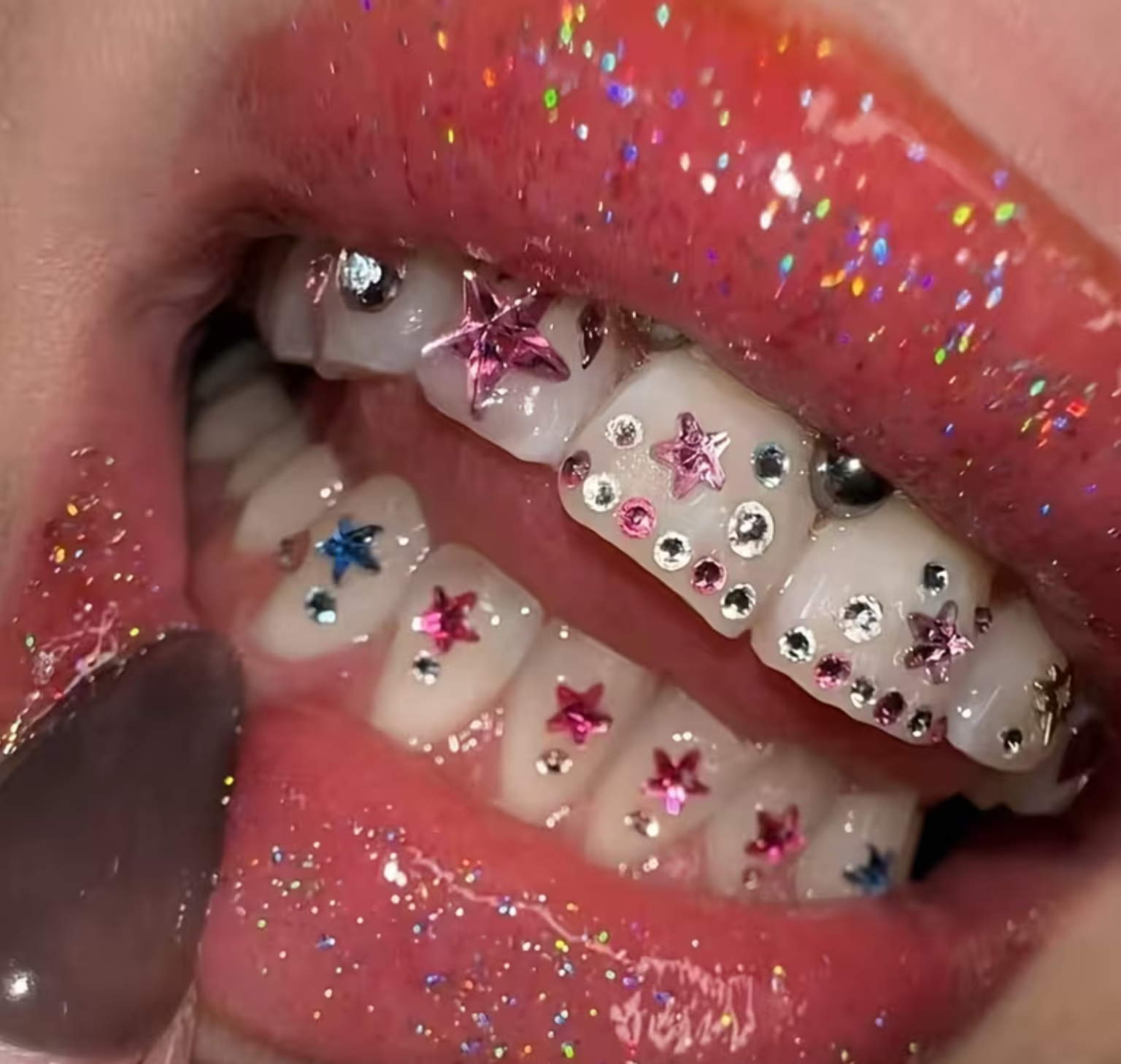 Kit Sourire Tendance Y2K – Édition Mignonne & Luxueuse