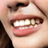 Grillz Inférieurs "Flexible Ice" en Zircone – Image 3