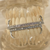 Grillz Luxe Léger & Zirconium-Le Duo "Pure Shine" – Image 7